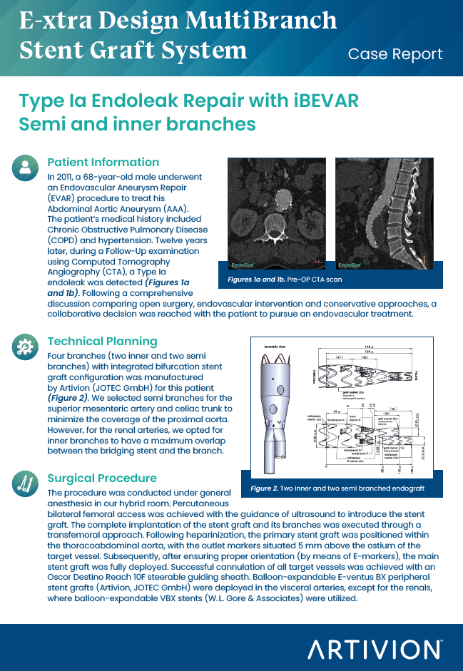 E-xtra Design MultiBranch Featured Case - Heerlen, Netherlands