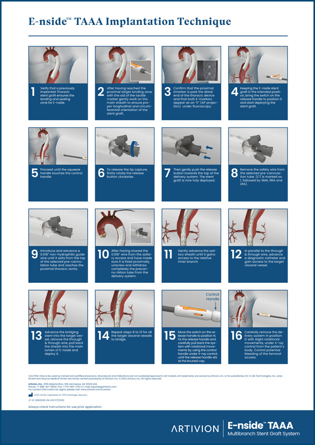 E-nside Implantation Poster, English