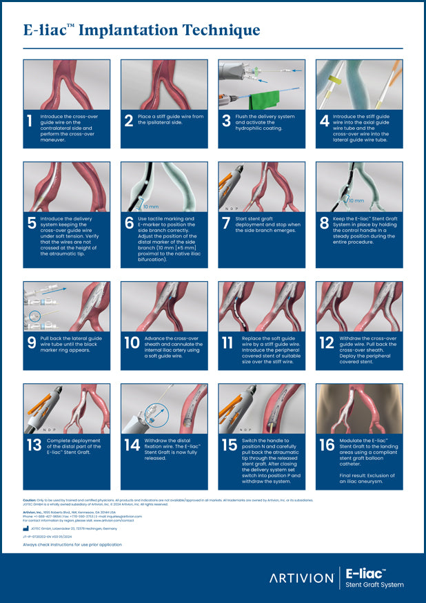 E-liac Implantation Poster