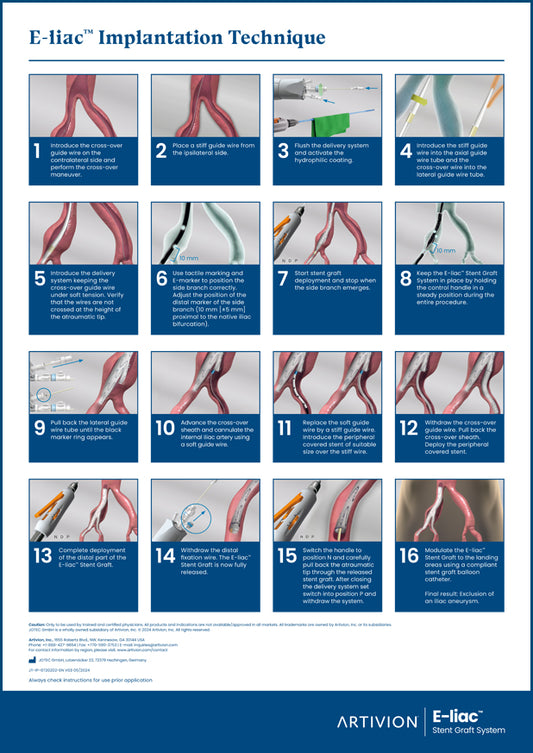 E-liac Implantation Poster