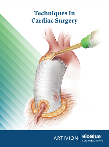 BioGlue for Cardiac Surgery, English