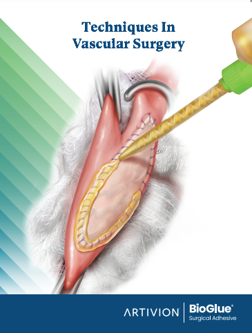 BioGlue for Vascular Surgery, English