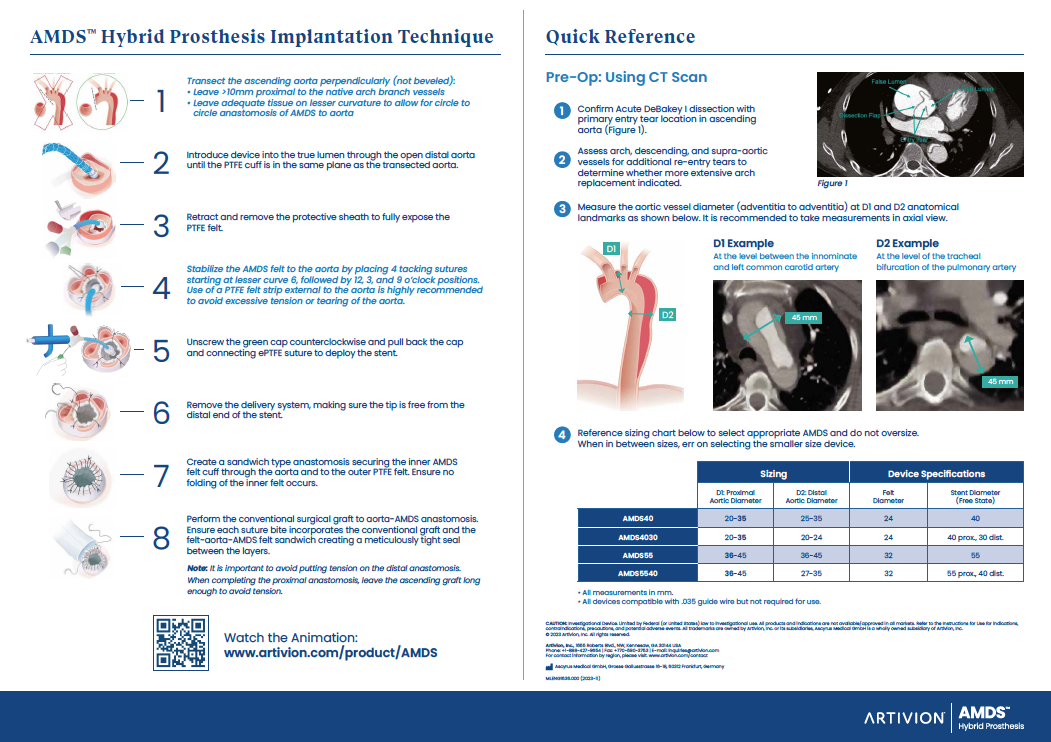 AMDS Implantation Poster