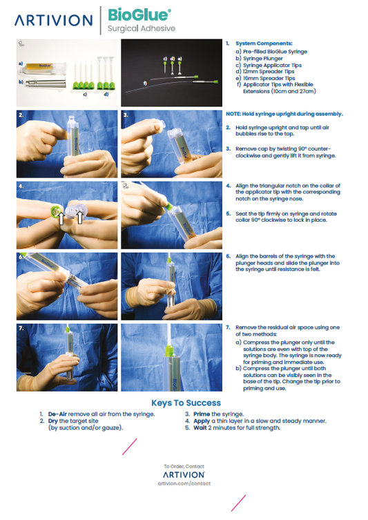 BioGlue Syringe Wall Chart