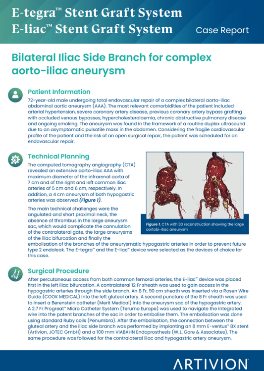 AAA Iliac side branch devices for type 1b endoleak repair in tortuous anatomy- Featured Case