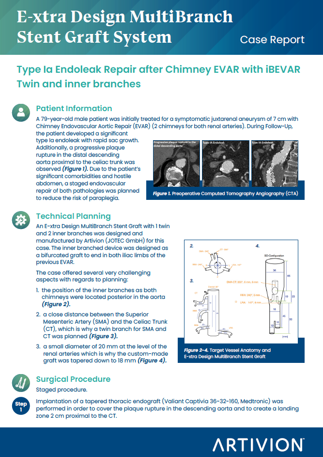 E-xtra Design MultiBranch Featured Case - Stuttgart, Germany