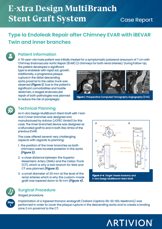 E-xtra Design MultiBranch Featured Case - Stuttgart, Germany