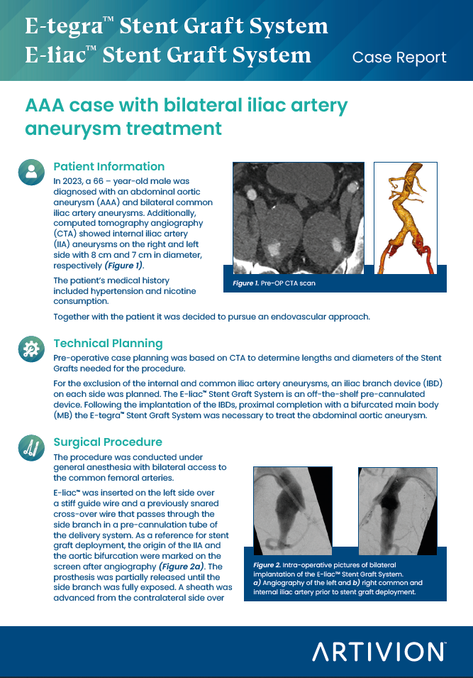 AAA with bilateral iliac artery aneurysm treatment - Featured Case