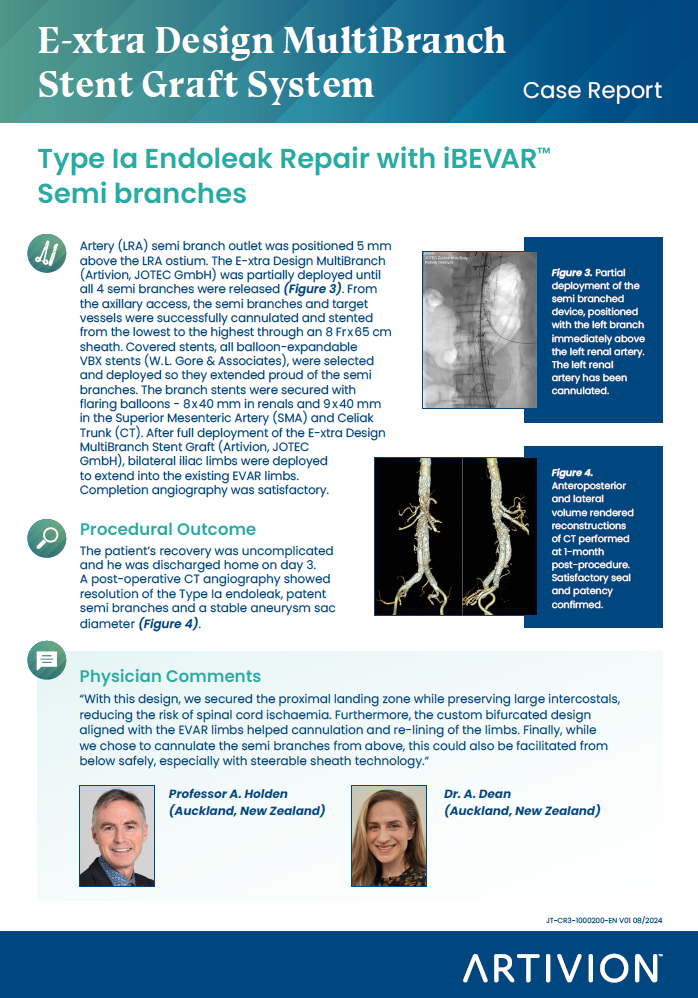 E-xtra Design MultiBranch Stent Graft System - Type Ia Endoleak Repair with iBEVAR™ Semi branches Case Report