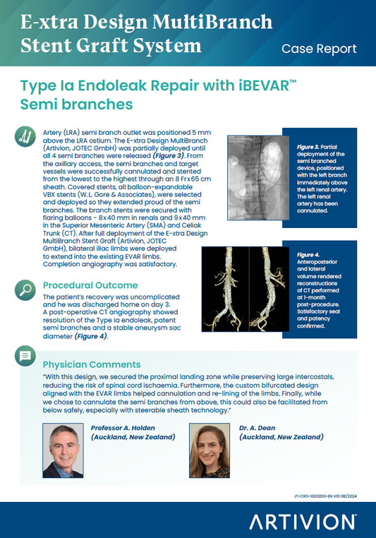 E-xtra Design MultiBranch Stent Graft System - Type Ia Endoleak Repair with iBEVAR™ Semi branches Case Report