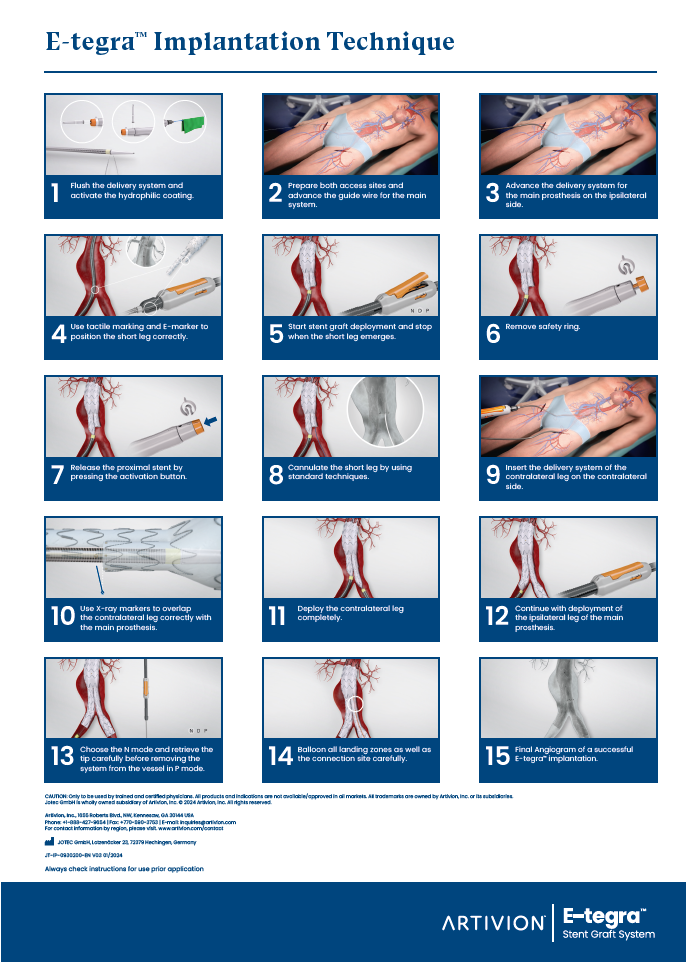 E-tegra Implementation Process