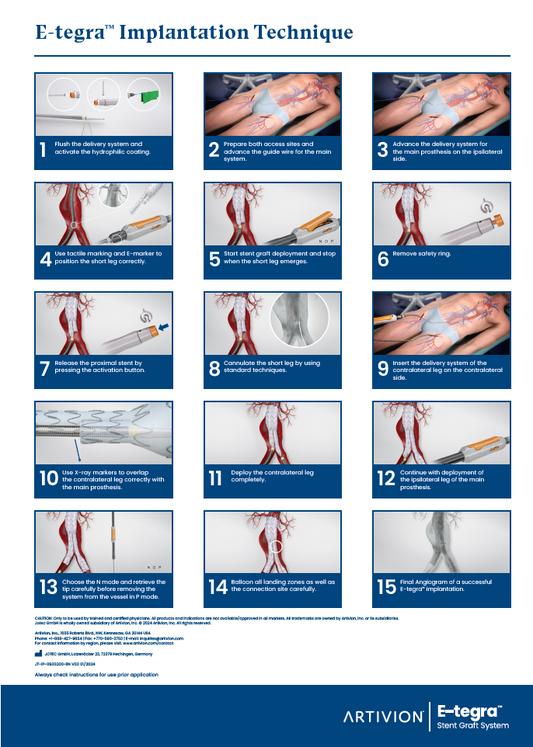 E-tegra Implementation Process