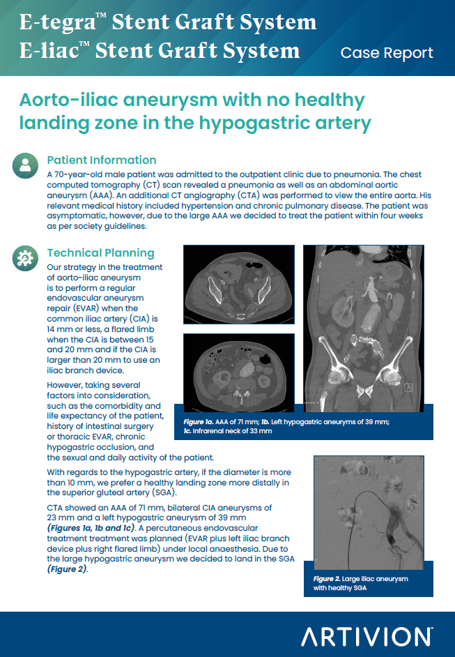 AAA Aorto-iliac aneurysm with no healthy landing zone in the hypogastric artery - Featured Case