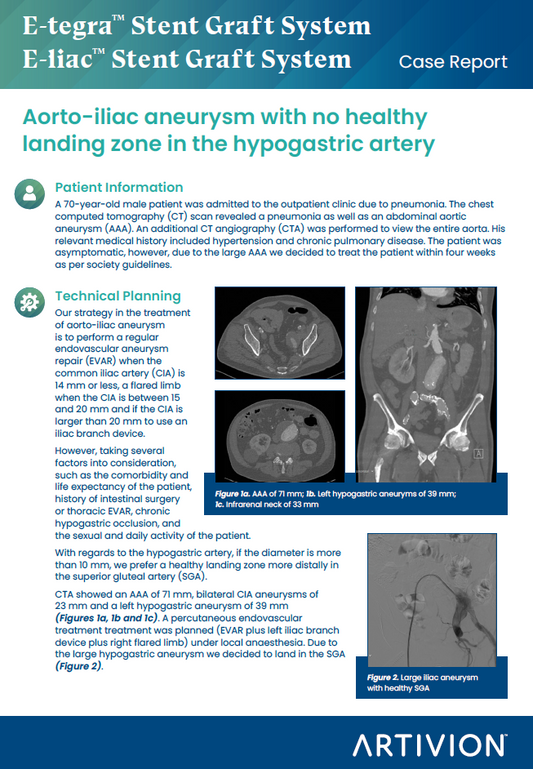 AAA Aorto-iliac aneurysm with no healthy landing zone in the hypogastric artery - Featured Case