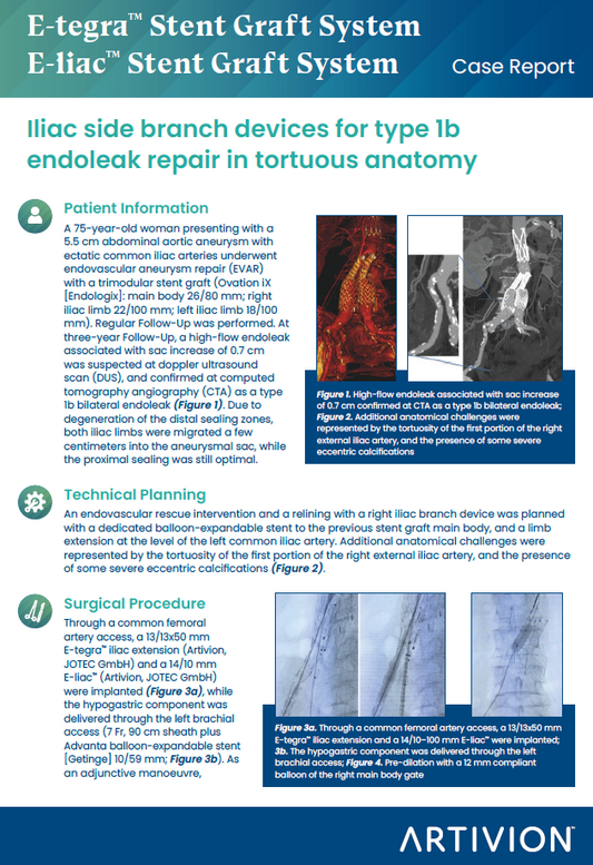 AAA Iliac side branch devices for type 1b endoleak repair in tortuous anatomy - Featured Case