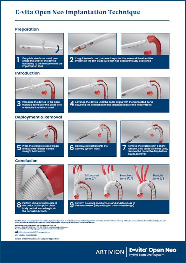 E-vita Open Neo Implantation Technique