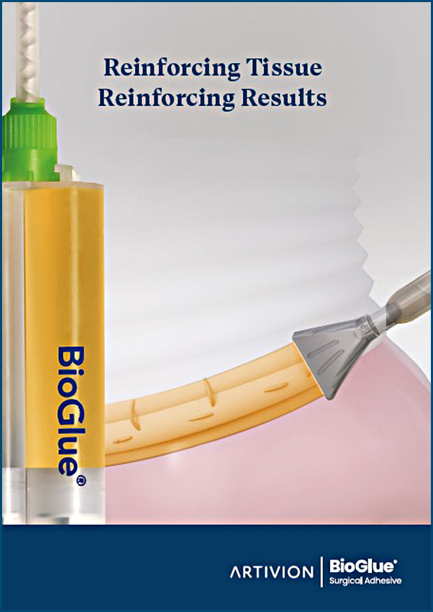 BioGlue Cross Selling Brochure