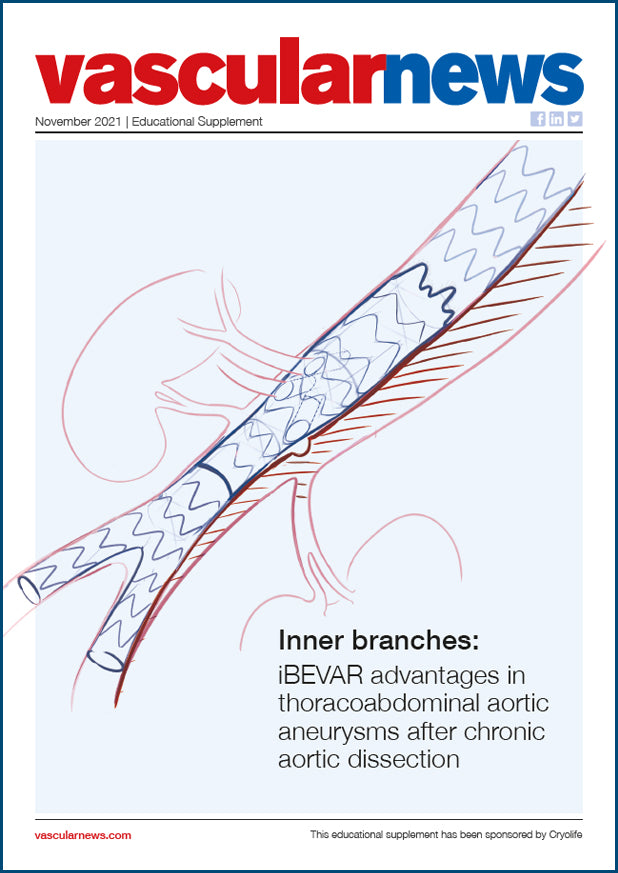 Vascularnews 2021 iBEVAR in TAADs