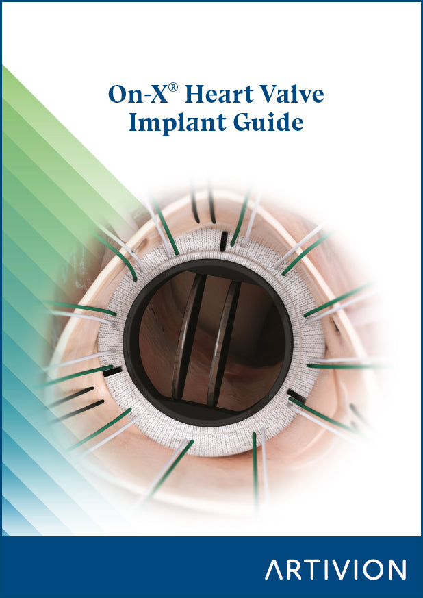 On-X Heart Valve Implant Guide